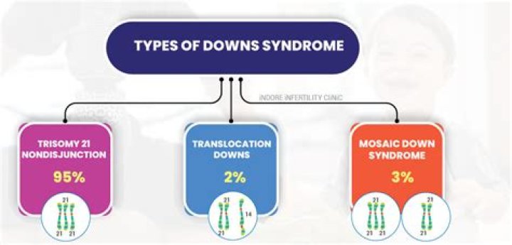 Does Crew Have Down Syndrome? Understanding the Condition and Its Impact