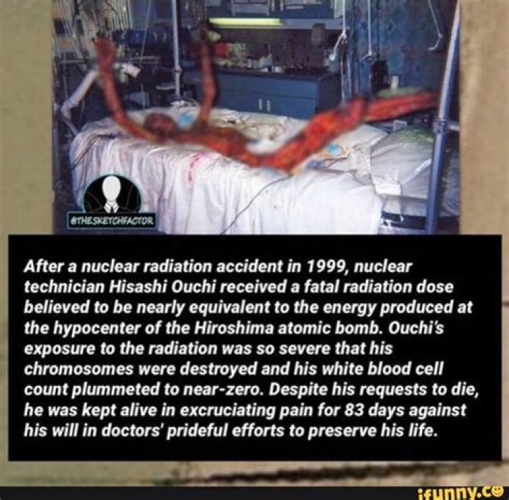 Exploring the Life and Legacy of Hisashi Ouchi: A Tragic Tale of Radiation Exposure
