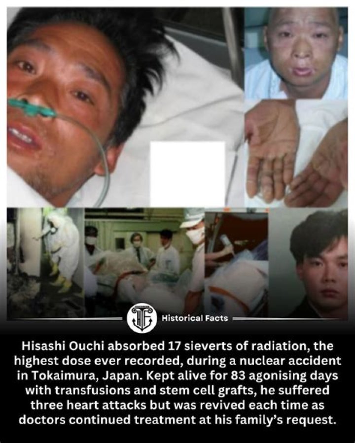 Exploring the Reality of Hisashi Ouchi's Body: A True Story