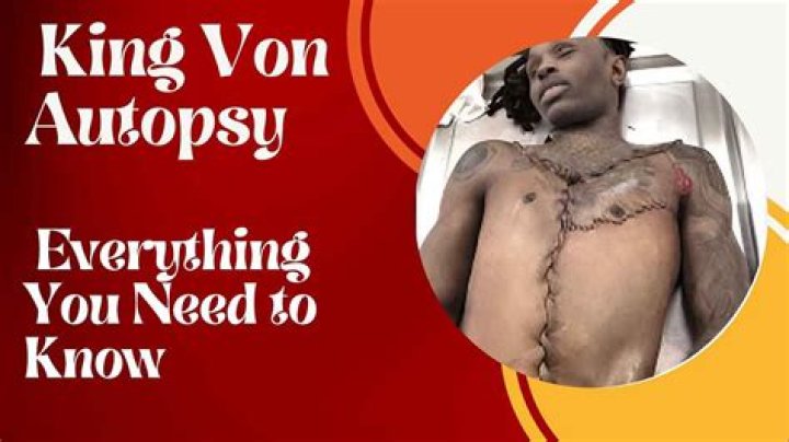 King Von Autopsy Full: Unveiling the Truth Behind His Tragic Death
