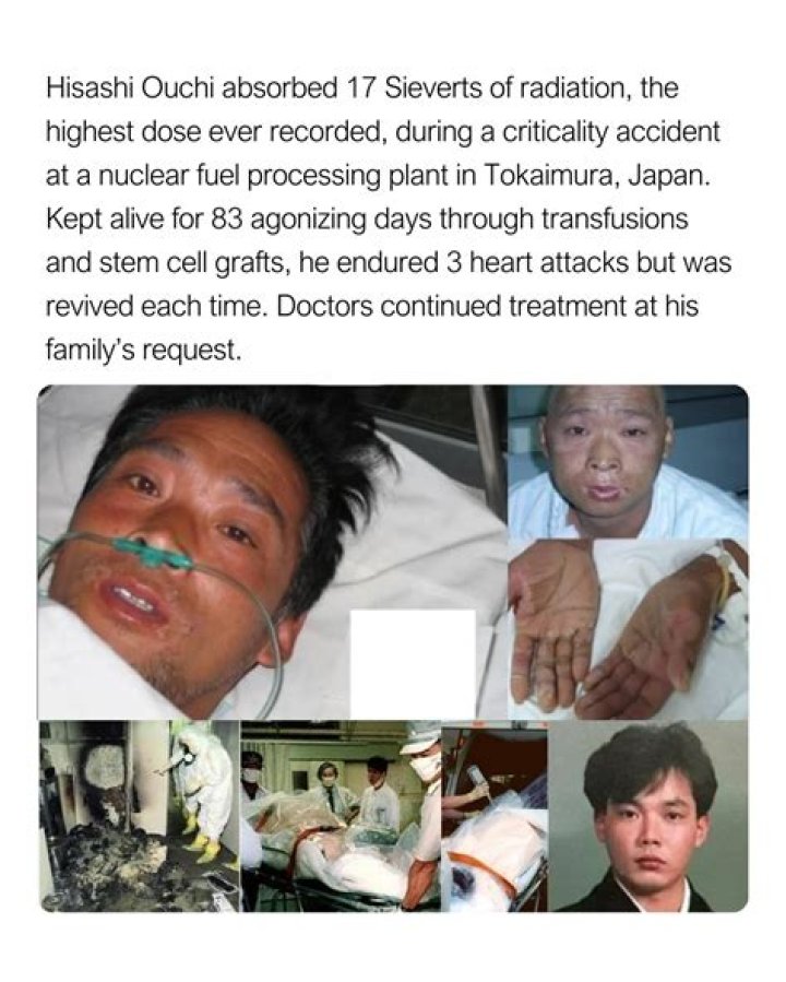 Understanding the Hisashi Ouchi Case: A Tragic Incident in Nuclear History